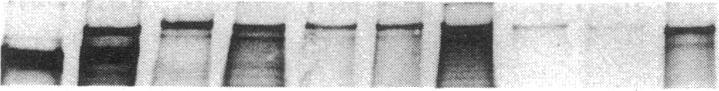 https://cdn.ncbi.nlm.nih.gov/pmc/blobs/a882/287951/27dc50f9662e/jcinvest00037-0076-a.jpg