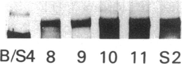 https://cdn.ncbi.nlm.nih.gov/pmc/blobs/a882/287951/3201423b46e5/jcinvest00037-0076-b.jpg