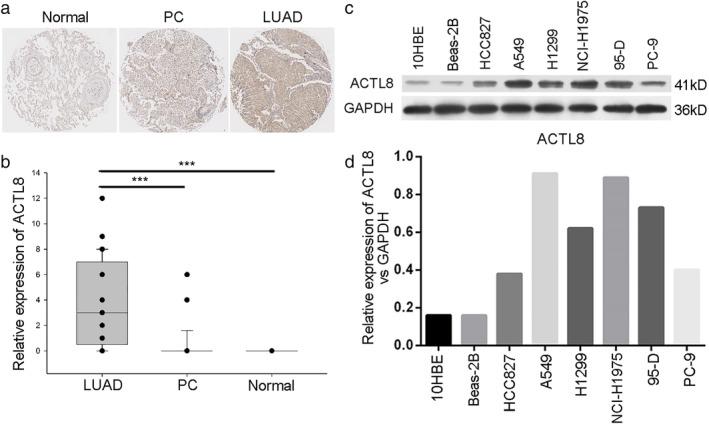 https://cdn.ncbi.nlm.nih.gov/pmc/blobs/a887/7049497/7eee067fbd06/TCA-11-526-g001.jpg