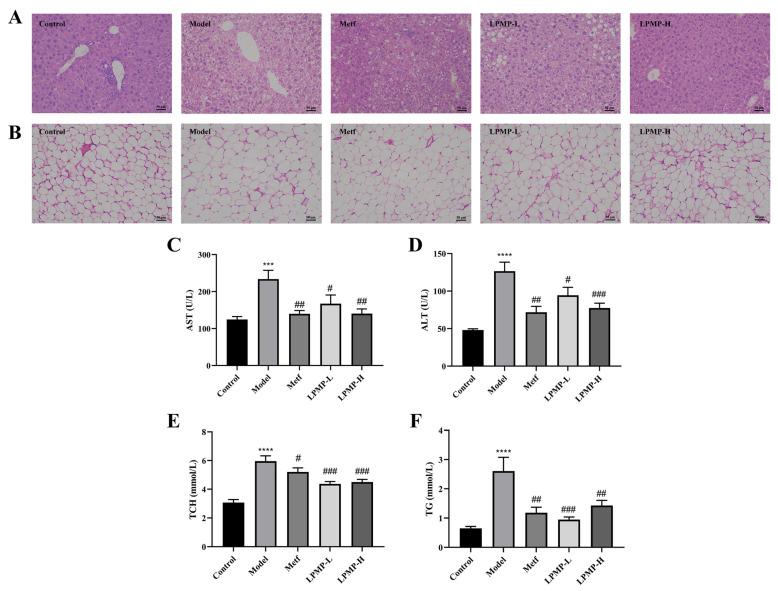 https://cdn.ncbi.nlm.nih.gov/pmc/blobs/a888/8657924/18b88a07f50d/ijms-22-12693-g009.jpg