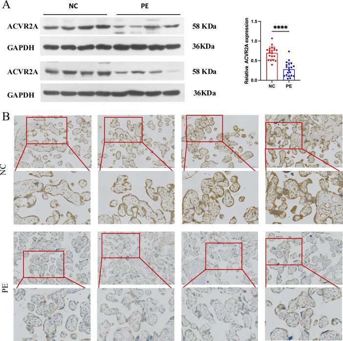 https://cdn.ncbi.nlm.nih.gov/pmc/blobs/a88e/12124833/80461758260e/elife-101236-fig1-figsupp1.jpg