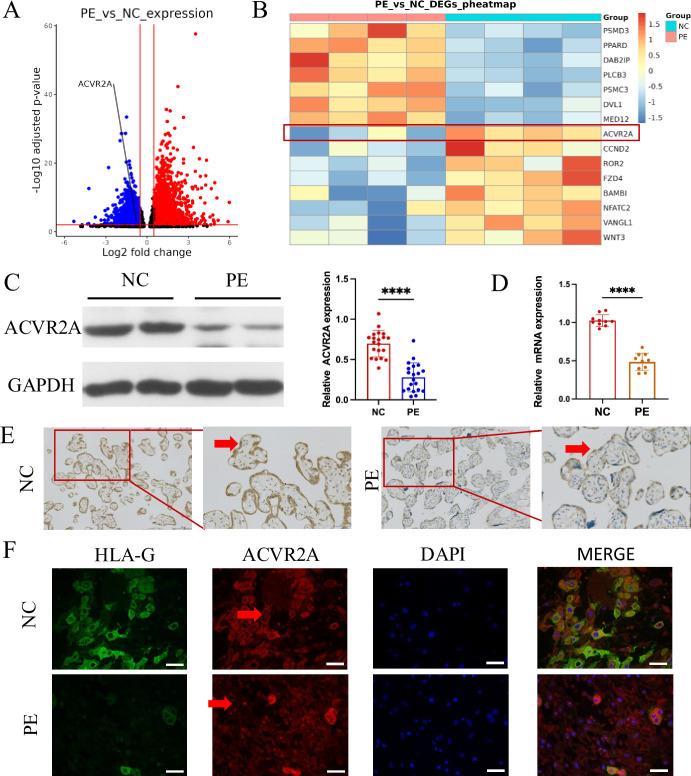 https://cdn.ncbi.nlm.nih.gov/pmc/blobs/a88e/12124833/a4721d843e40/elife-101236-fig1.jpg