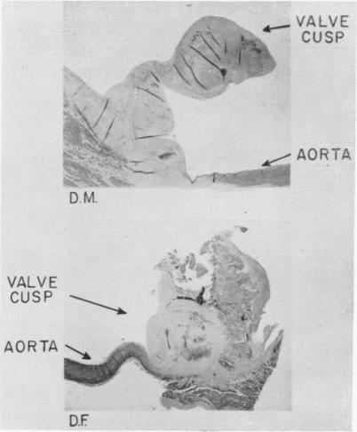 https://cdn.ncbi.nlm.nih.gov/pmc/blobs/a890/1613335/811a7f1afd34/annsurg01298-0014-a.jpg