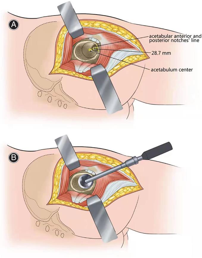 https://cdn.ncbi.nlm.nih.gov/pmc/blobs/a899/8755880/cb6b18df7ea5/OS-14-119-g001.jpg