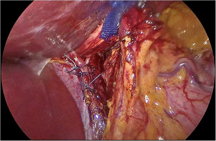 https://cdn.ncbi.nlm.nih.gov/pmc/blobs/a89d/12003324/5ec88b7a754d/fsurg-12-1513695-g002.jpg