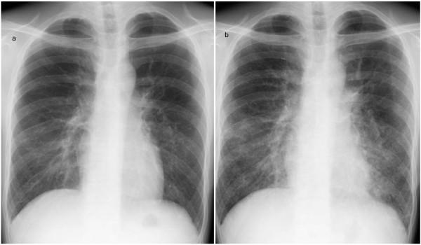 https://cdn.ncbi.nlm.nih.gov/pmc/blobs/a8a0/3423016/bad602d4b570/1752-1947-6-191-1.jpg