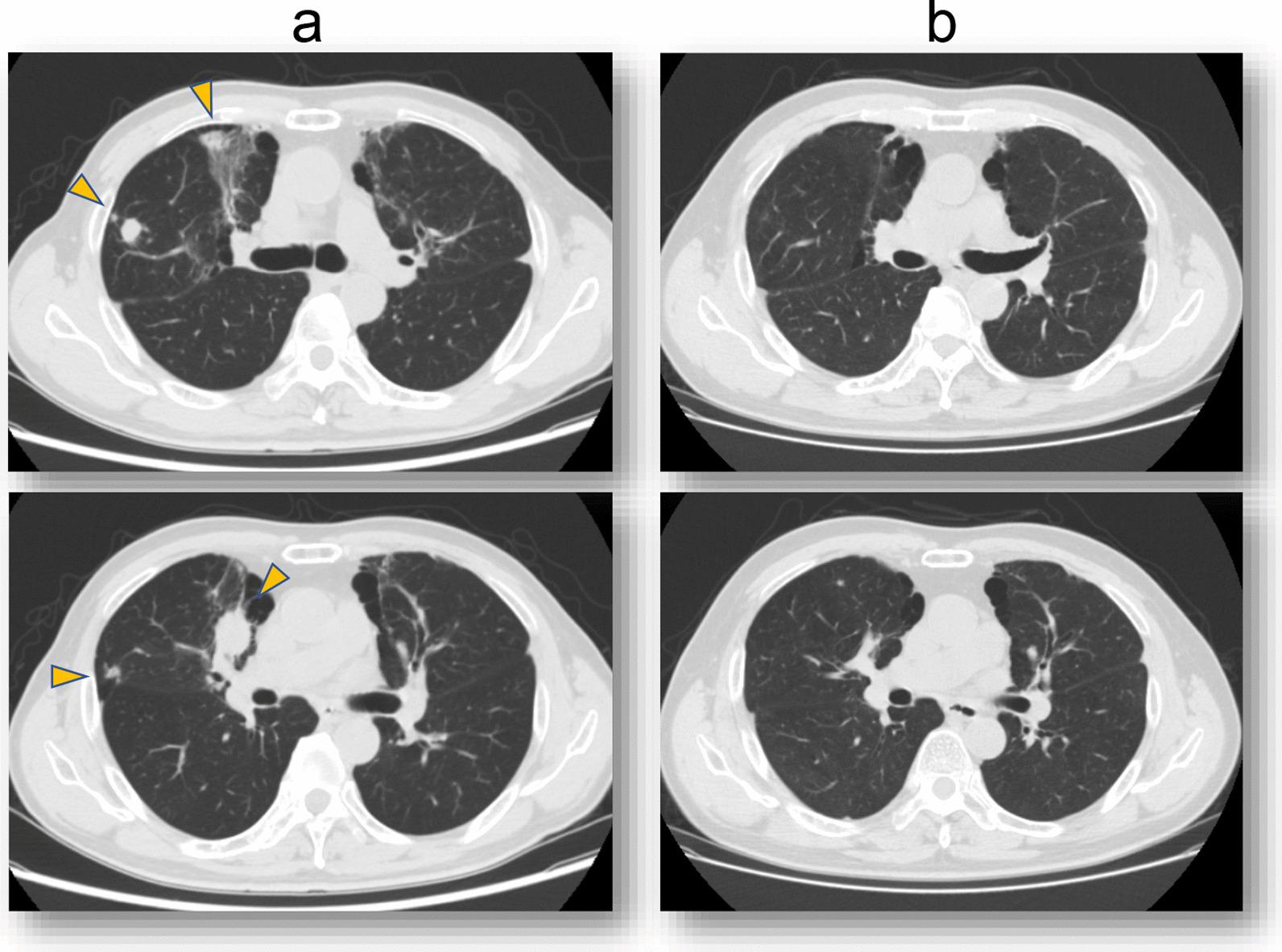 https://cdn.ncbi.nlm.nih.gov/pmc/blobs/a8a5/9116048/05f697a6689e/13256_2022_3426_Fig6_HTML.jpg