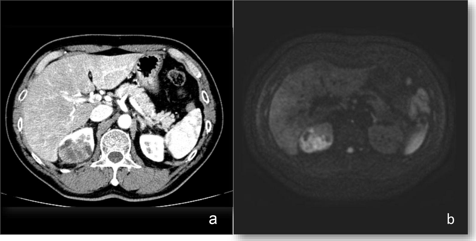 https://cdn.ncbi.nlm.nih.gov/pmc/blobs/a8a5/9116048/a4f4dab513a3/13256_2022_3426_Fig1_HTML.jpg