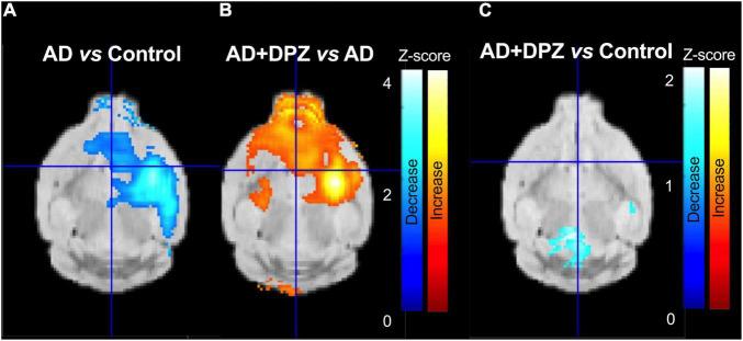 https://cdn.ncbi.nlm.nih.gov/pmc/blobs/a8a7/8916213/01a37f30a72b/fnins-16-835577-g004.jpg