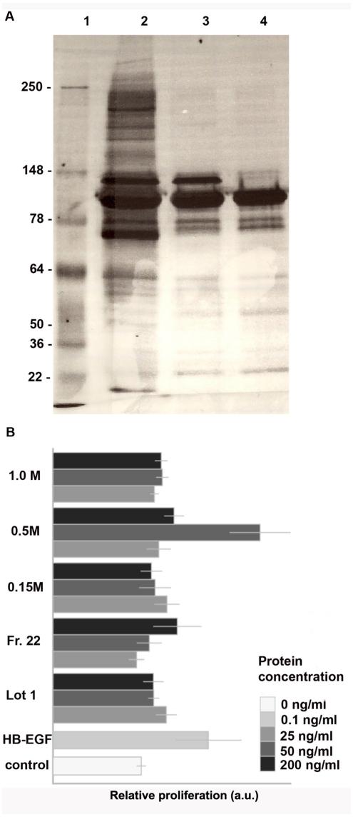https://cdn.ncbi.nlm.nih.gov/pmc/blobs/a8a9/3285658/e6cd5c7abedd/pone.0032146.g003.jpg