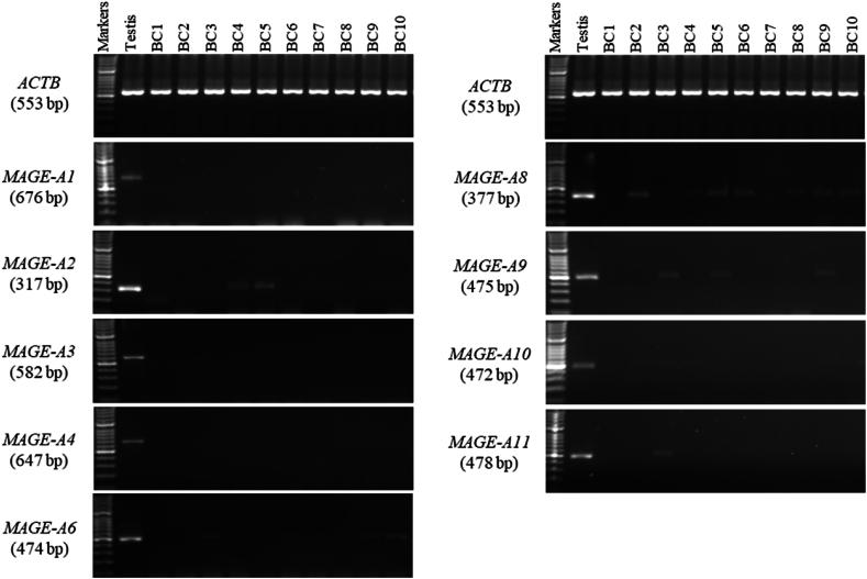 https://cdn.ncbi.nlm.nih.gov/pmc/blobs/a8aa/11284374/cfaf7e290e73/gr1.jpg