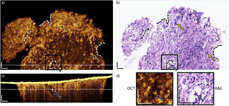 https://cdn.ncbi.nlm.nih.gov/pmc/blobs/a8b2/7747926/56119061687e/boe-11-12-7003-g003.jpg