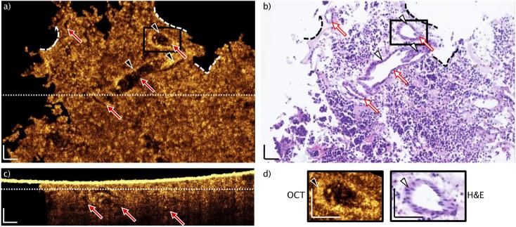https://cdn.ncbi.nlm.nih.gov/pmc/blobs/a8b2/7747926/72d63a6b4431/boe-11-12-7003-g004.jpg