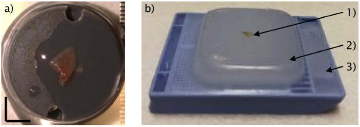 https://cdn.ncbi.nlm.nih.gov/pmc/blobs/a8b2/7747926/a7e68eacfab2/boe-11-12-7003-g001.jpg