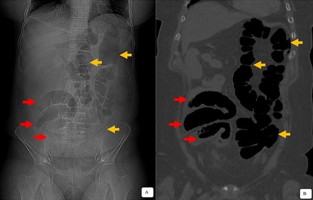 https://cdn.ncbi.nlm.nih.gov/pmc/blobs/a8ba/5511726/7db43f6160f6/PAMJ-27-3-g001.jpg