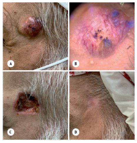 https://cdn.ncbi.nlm.nih.gov/pmc/blobs/a8bb/10370377/53e7ae2b5cfa/SaudiMedJ-44-7-667_4_3.jpg