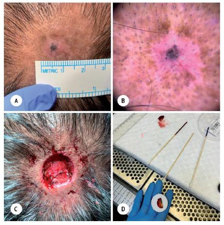 https://cdn.ncbi.nlm.nih.gov/pmc/blobs/a8bb/10370377/d1edc4e584e8/SaudiMedJ-44-7-667_4_2.jpg