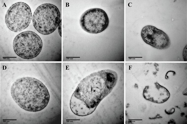 https://cdn.ncbi.nlm.nih.gov/pmc/blobs/a8bf/10300259/40077804f40e/gr6.jpg