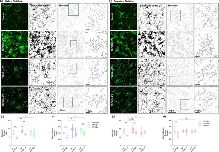https://cdn.ncbi.nlm.nih.gov/pmc/blobs/a8cc/12334870/efead19d6564/GLIA-73-2035-g011.jpg
