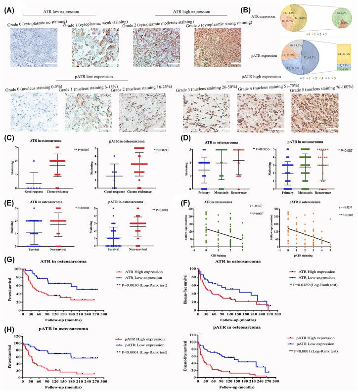 https://cdn.ncbi.nlm.nih.gov/pmc/blobs/a8d1/7493280/7a6e83ed71e1/10.1177_1758835920956900-fig1.jpg