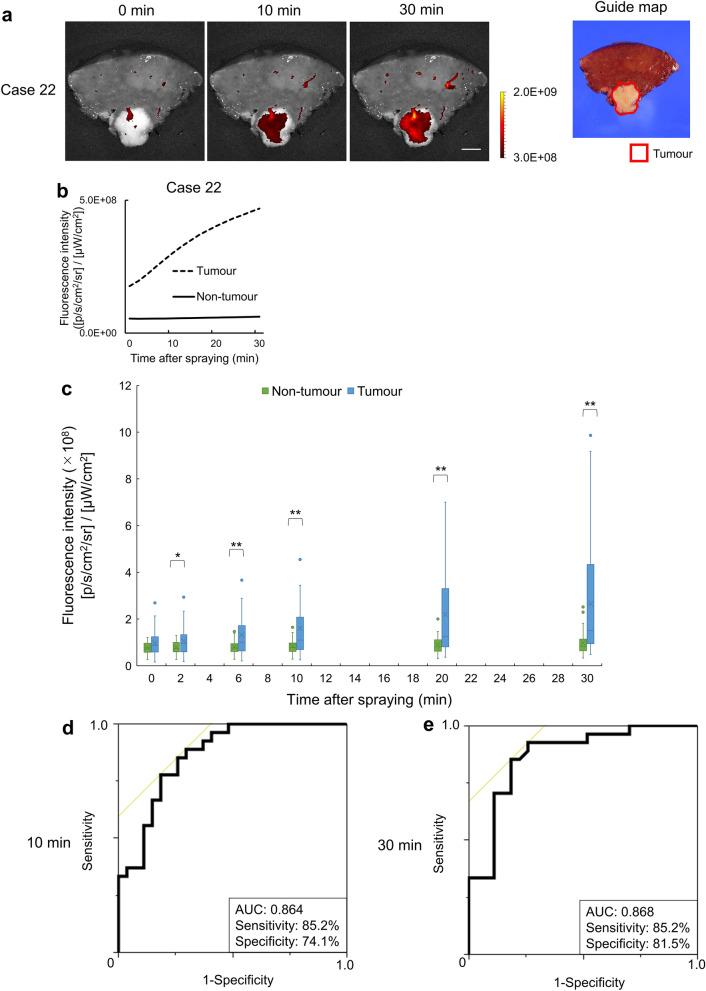 https://cdn.ncbi.nlm.nih.gov/pmc/blobs/a8d5/8429424/4ccd5c3c4533/41598_2021_97073_Fig4_HTML.jpg
