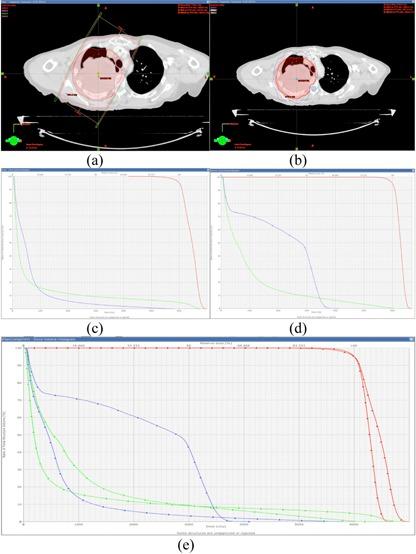 https://cdn.ncbi.nlm.nih.gov/pmc/blobs/a8db/5711051/74d48bb1dcb7/ACM2-15-102-g007.jpg