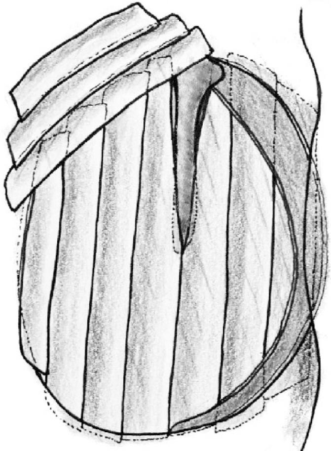 https://cdn.ncbi.nlm.nih.gov/pmc/blobs/a8df/3846220/95c053db309b/ijo-24-105-g002.jpg