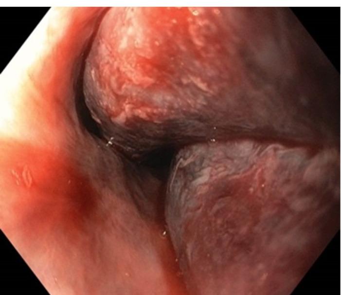 https://cdn.ncbi.nlm.nih.gov/pmc/blobs/a8f0/9339736/31a674692b8c/jcvtr-14-144-g001.jpg