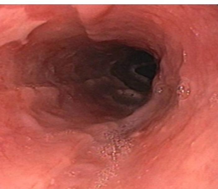 https://cdn.ncbi.nlm.nih.gov/pmc/blobs/a8f0/9339736/e86d3e50cf8c/jcvtr-14-144-g003.jpg