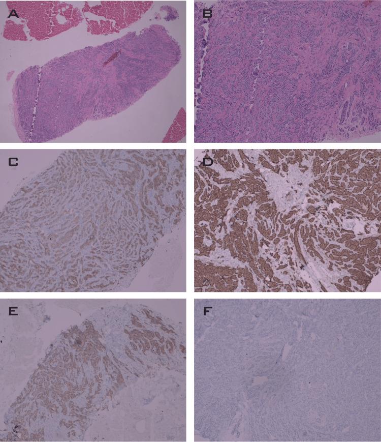 https://cdn.ncbi.nlm.nih.gov/pmc/blobs/a8f1/10359153/726ca0122249/cureus-0015-00000040703-i03.jpg