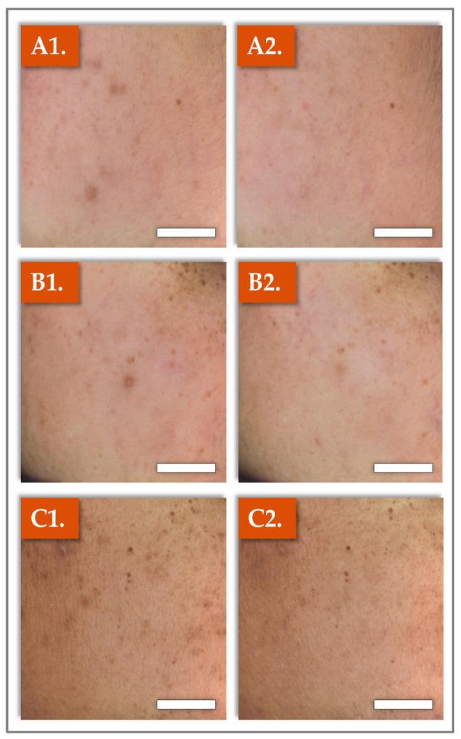 https://cdn.ncbi.nlm.nih.gov/pmc/blobs/a8f6/12294899/0c8eedc284a2/gels-11-00495-g002.jpg