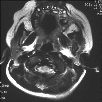 https://cdn.ncbi.nlm.nih.gov/pmc/blobs/a8f8/5422897/bbc07fa6efe4/13256_2017_1286_Fig2_HTML.jpg