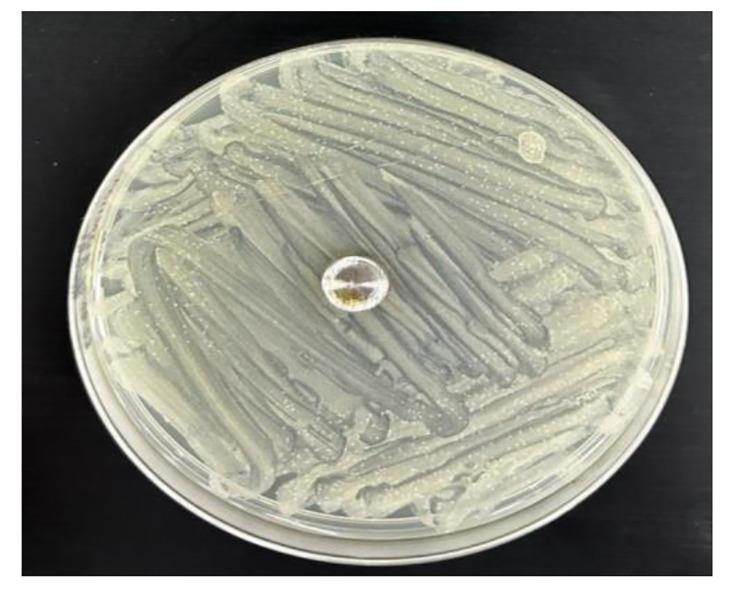 https://cdn.ncbi.nlm.nih.gov/pmc/blobs/a8fd/11724499/bf867f70e993/13018_2025_5467_Fig1_HTML.jpg
