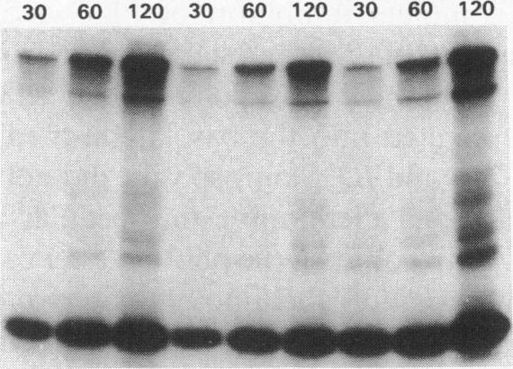 https://cdn.ncbi.nlm.nih.gov/pmc/blobs/a901/288457/4fabf0fde0e4/jcinvest00044-0064-c.jpg