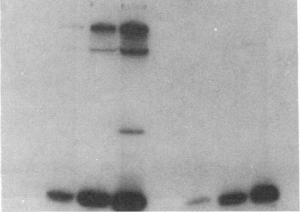 https://cdn.ncbi.nlm.nih.gov/pmc/blobs/a901/288457/86ff586772d6/jcinvest00044-0063-f.jpg