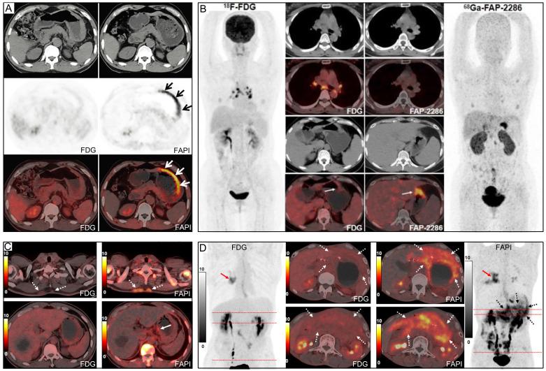 https://cdn.ncbi.nlm.nih.gov/pmc/blobs/a903/10465231/0e1e8cd122b3/thnov13p4694g008.jpg