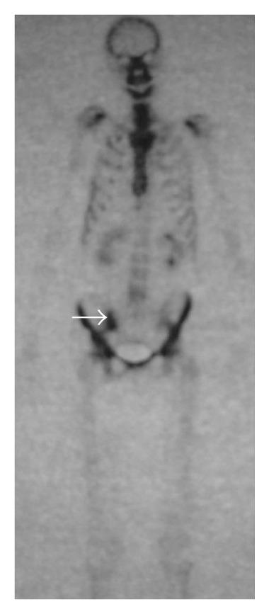 https://cdn.ncbi.nlm.nih.gov/pmc/blobs/a903/4137595/d8ddceec4222/CRIRH2014-925961.001.jpg