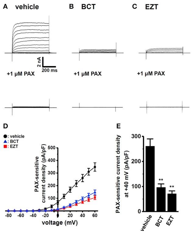 https://cdn.ncbi.nlm.nih.gov/pmc/blobs/a906/5911984/6af40e9d886f/fphys-09-00312-g0003.jpg