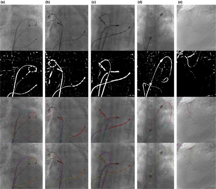https://cdn.ncbi.nlm.nih.gov/pmc/blobs/a908/6282599/8bfba3f6c98e/MP-45-5066-g017.jpg