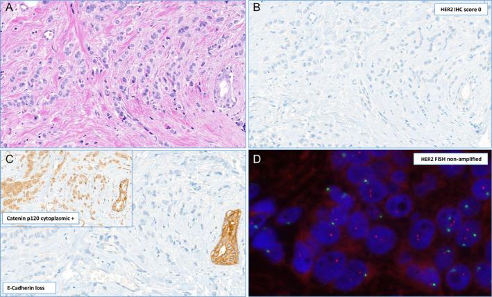 https://cdn.ncbi.nlm.nih.gov/pmc/blobs/a90f/10800294/62e59b8b8ba2/CJP2-10-e12362-g003.jpg