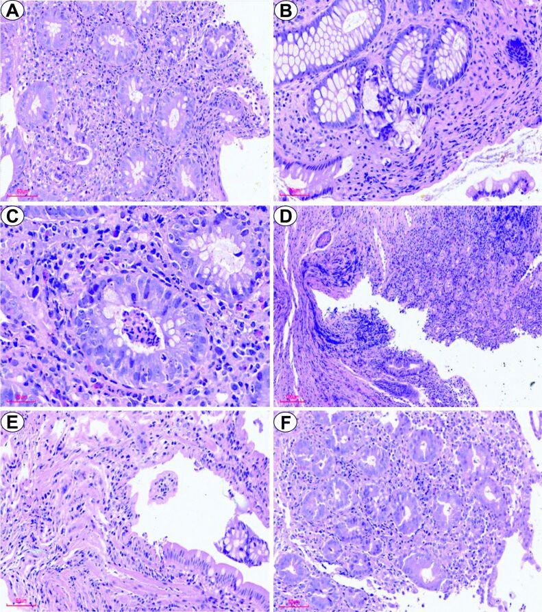 https://cdn.ncbi.nlm.nih.gov/pmc/blobs/a914/12236282/2ffec897ffad/RJME-66-1-205-fig1.jpg