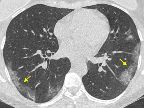 https://cdn.ncbi.nlm.nih.gov/pmc/blobs/a91b/7423824/4dd45f5a02bd/13089_2020_185_Fig7_HTML.jpg