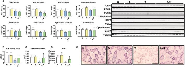 https://cdn.ncbi.nlm.nih.gov/pmc/blobs/a920/7749603/1697e5200687/JCSM-11-1779-g005.jpg