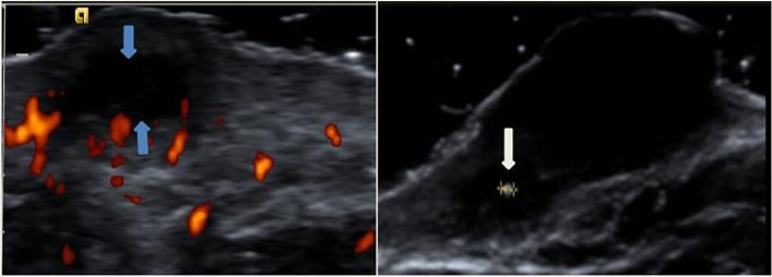 https://cdn.ncbi.nlm.nih.gov/pmc/blobs/a921/8639709/23c16e4b64fa/41598_2021_2730_Fig2_HTML.jpg