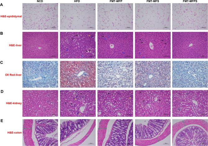 https://cdn.ncbi.nlm.nih.gov/pmc/blobs/a92f/12316889/ef6b2400caef/41598_2025_13715_Fig5_HTML.jpg