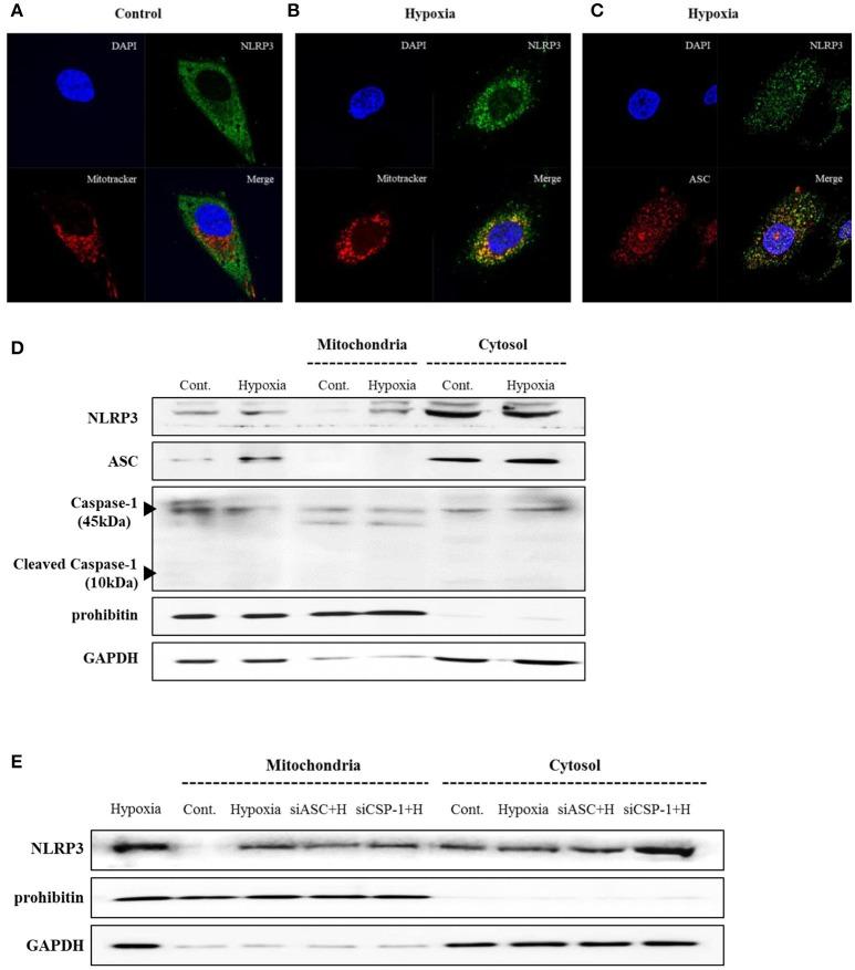 https://cdn.ncbi.nlm.nih.gov/pmc/blobs/a935/6240646/cd2118b9cc2b/fimmu-09-02563-g0002.jpg