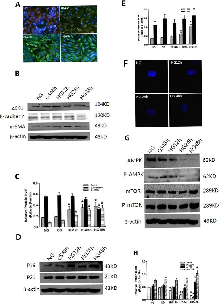 https://cdn.ncbi.nlm.nih.gov/pmc/blobs/a936/5369951/73ba4939e03d/oncotarget-08-16109-g004.jpg