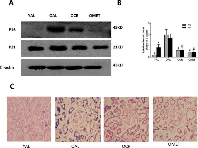 https://cdn.ncbi.nlm.nih.gov/pmc/blobs/a936/5369951/fb3d12a7de58/oncotarget-08-16109-g002.jpg