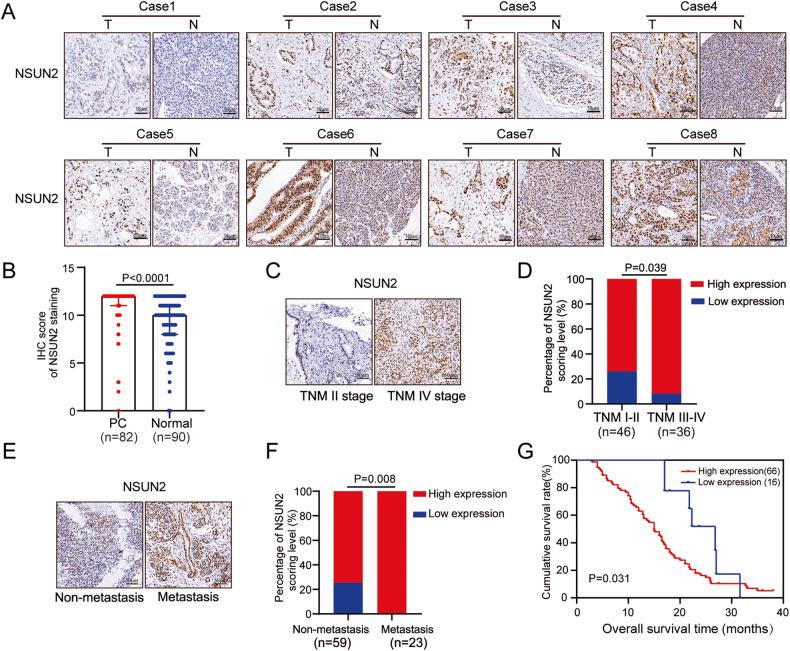 https://cdn.ncbi.nlm.nih.gov/pmc/blobs/a938/10314926/374ae9a31983/41420_2023_1521_Fig2_HTML.jpg