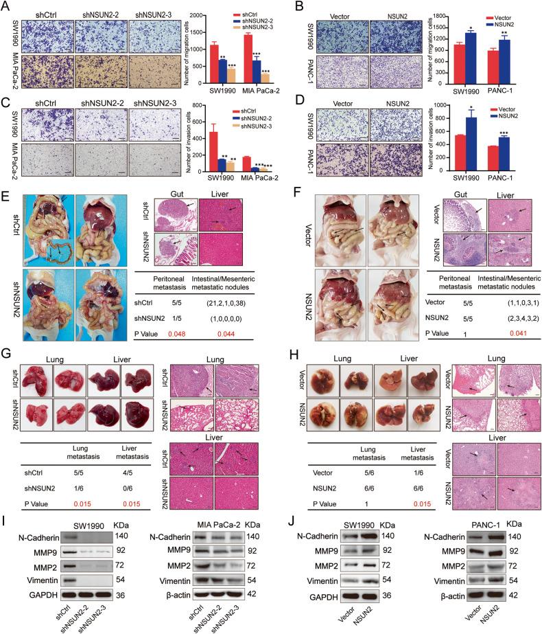 https://cdn.ncbi.nlm.nih.gov/pmc/blobs/a938/10314926/771e9ac1a285/41420_2023_1521_Fig4_HTML.jpg